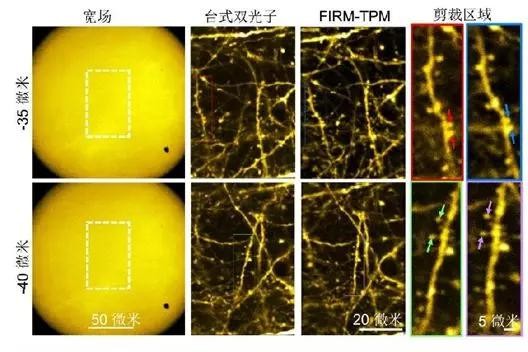 超快光纖激光助力微型雙光子顯微成像系統(tǒng)研究